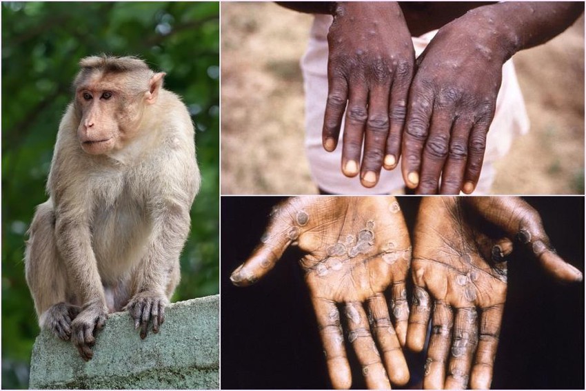 Hãy cùng tìm hiểu về các biện pháp phòng chống bệnh đậu mùa khỉ, một trong những bệnh truyền nhiễm có thể gây nguy hiểm đến sức khỏe con người và động vật. Hình ảnh sẽ giúp bạn hiểu rõ hơn về thiết bị và quy trình phòng chống bệnh đậu mùa khỉ trong môi trường công cộng.