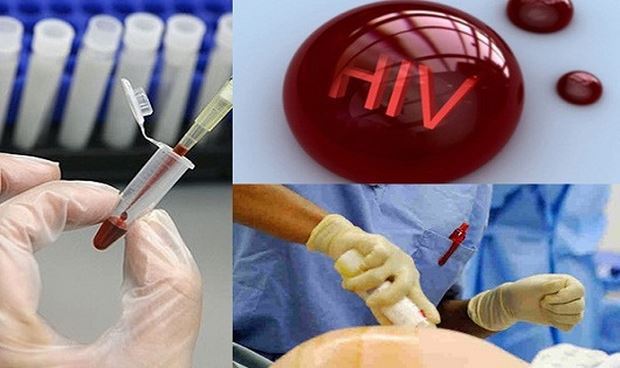 Điều kiện xác định người bị phơi nhiễm HIV, nhiễm HIV do tai nạn rủi ro  nghề nghiệp