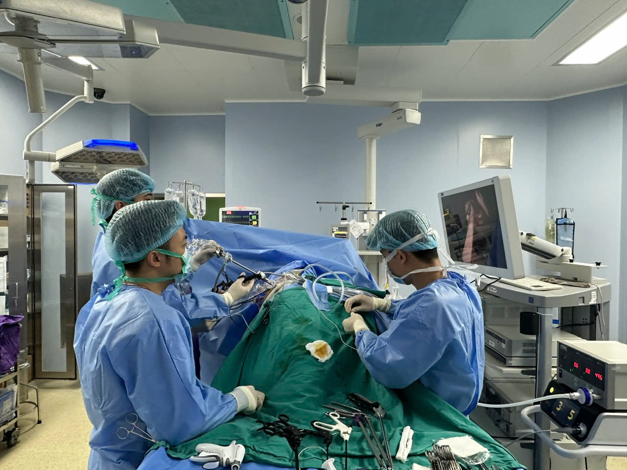 Lần đầu phẫu thuật thành công khối phình khổng lồ động mạch thận có ghép thận tự thân- Ảnh 1.