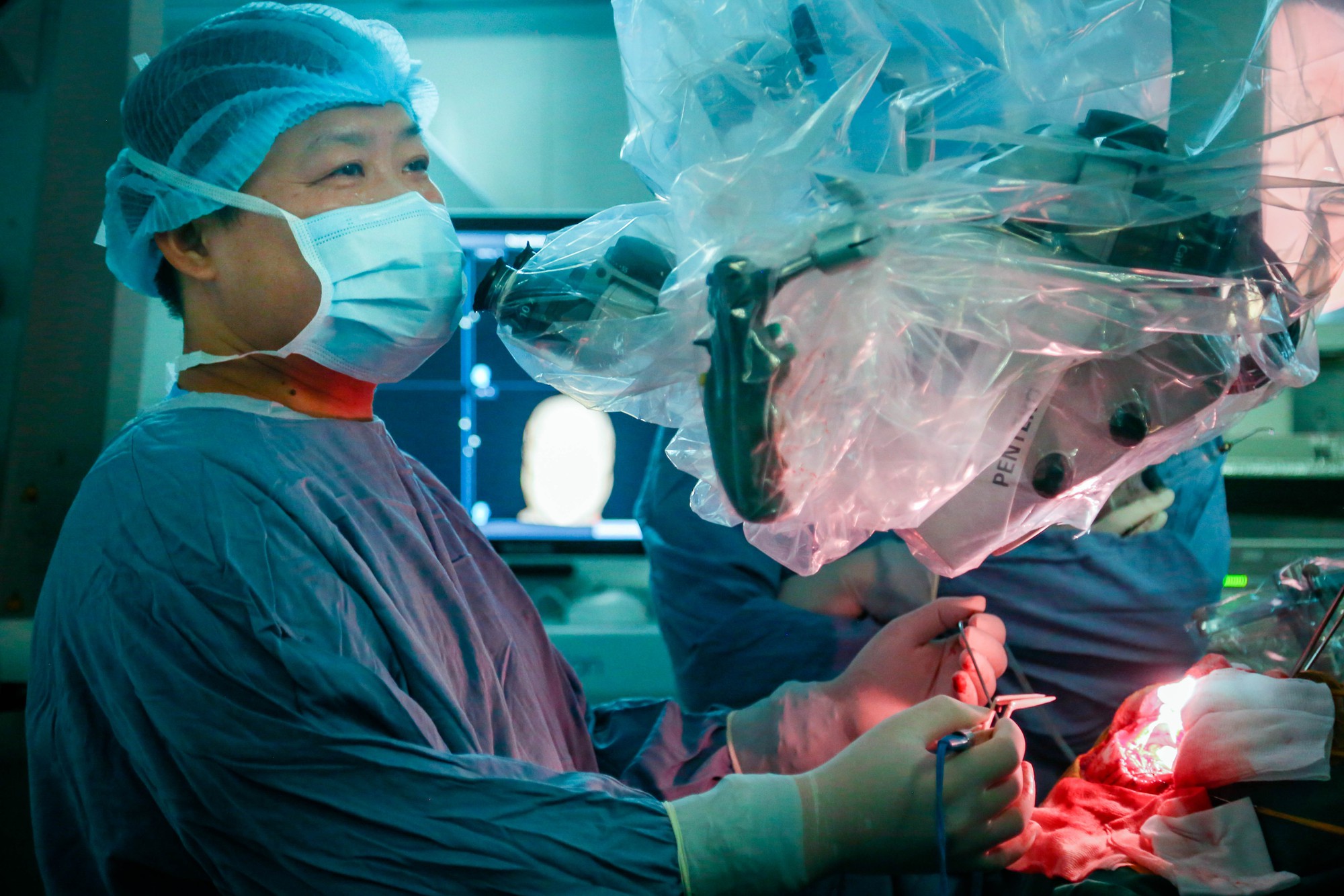 Lần đầu tiên cắt bỏ u tuyến yên bằng 2 cuộc đại phẫu cùng lúc- Ảnh 4. Lần đầu tiên cắt bỏ u tuyến yên bằng 2 cuộc đại phẫu cùng lúc- Ảnh 4.