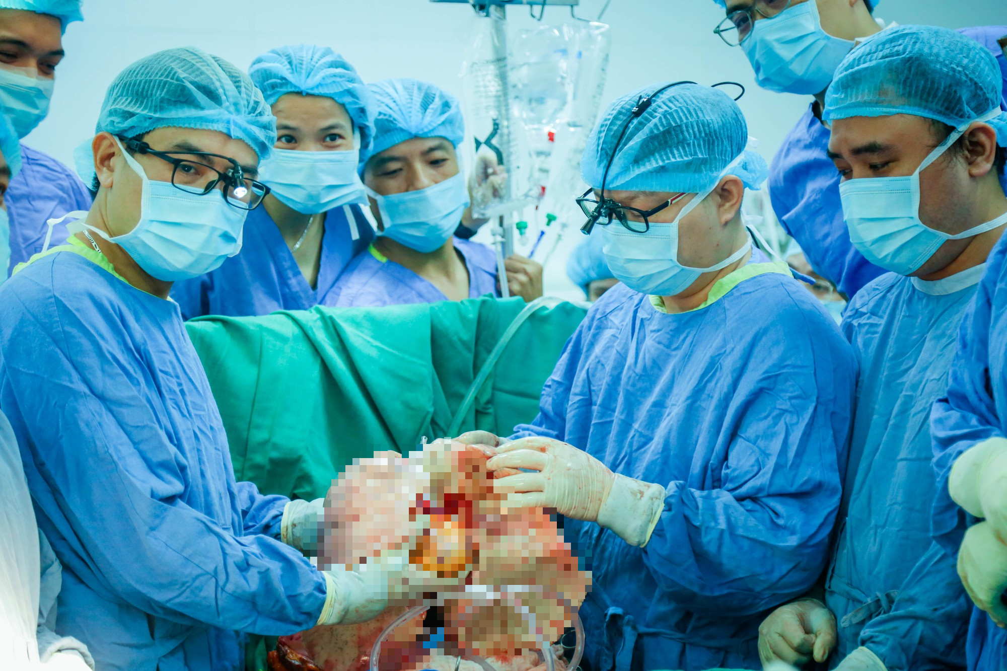Lần đầu tiên Việt Nam ghép thành công đồng thời tim và phổi cho người suy đa tạng- Ảnh 2. Lần đầu tiên Việt Nam ghép thành công đồng thời tim và phổi cho người suy đa tạng- Ảnh 2.