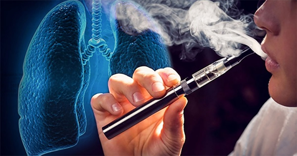 Tăng cường xử lý hành vi quảng cáo, bán thuốc lá điện tử theo hình thức thương mại điện tử- Ảnh 1. Tăng cường xử lý hành vi quảng cáo, bán thuốc lá điện tử theo hình thức thương mại điện tử- Ảnh 1.