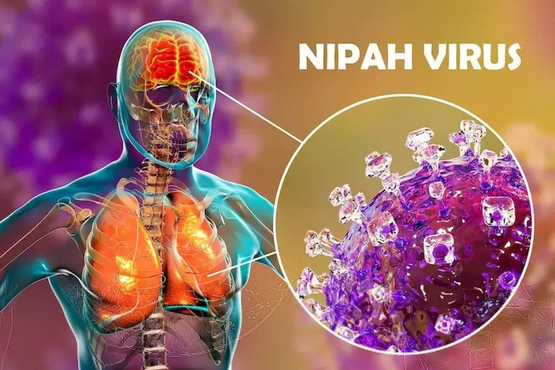 Virus Nipal không có nguy cơ bùng dịch lớn nếu thực hiện tốt các biện pháp phòng ngừa- Ảnh 2.