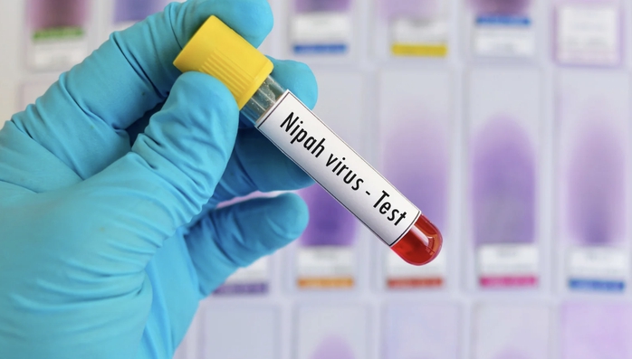 Không chủ quan với dịch bệnh do virus Nipah- Ảnh 1. Không chủ quan với dịch bệnh do virus Nipah- Ảnh 1.