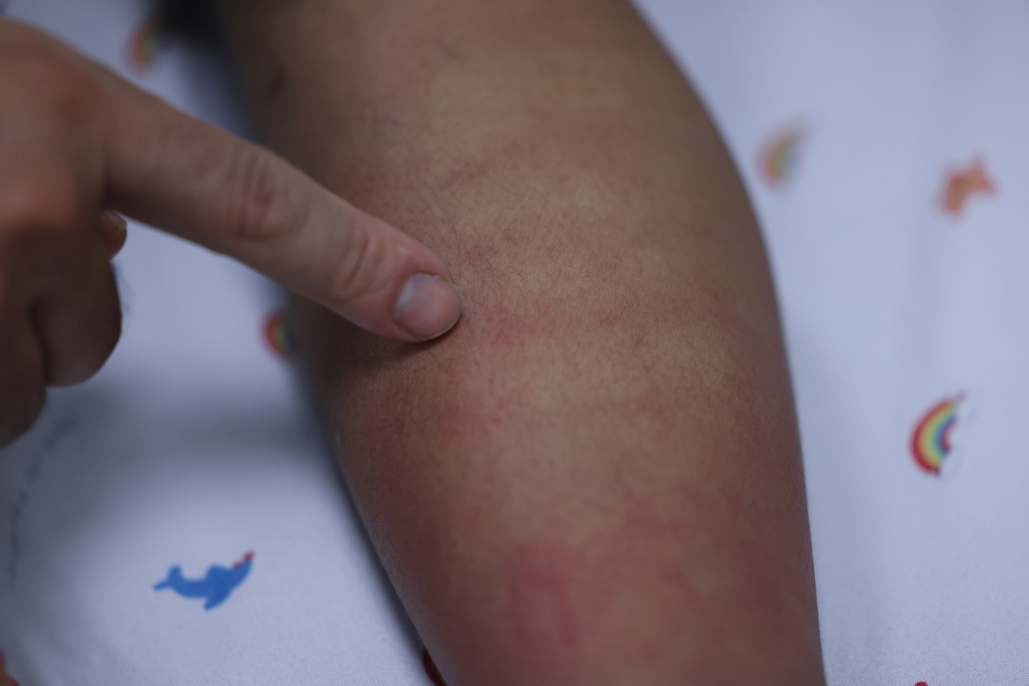 Sốt xuất huyết Dengue và những dự định dở dang bên giường bệnh- Ảnh 2. Sốt xuất huyết Dengue và những dự định dở dang bên giường bệnh- Ảnh 2.