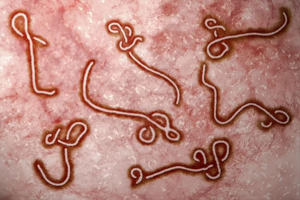 WHO báo động khẩn về Ebola ở châu Phi, Việt Nam tăng giám sát cửa khẩu- Ảnh 1. WHO báo động khẩn về Ebola ở châu Phi, Việt Nam tăng giám sát cửa khẩu- Ảnh 1.