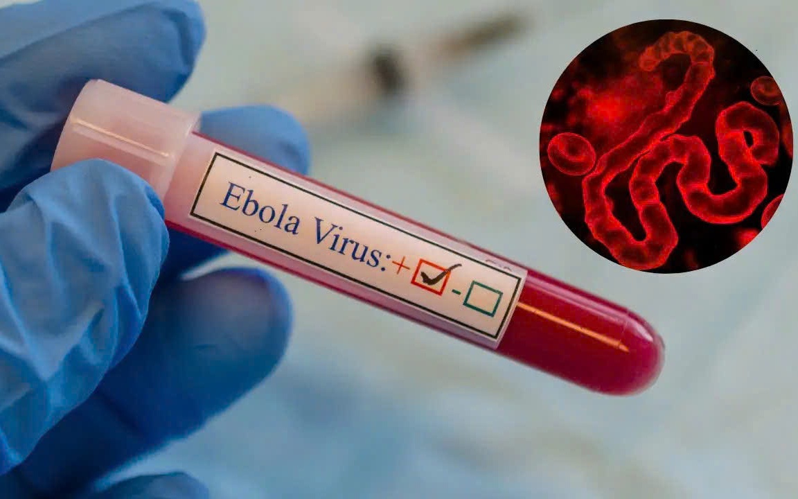 Virus Ebola có xu hướng lan rộng và biện pháp phòng ngừa của các nước