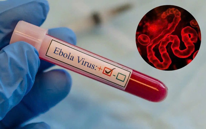Siết chặt kiểm soát dịch Ebola tại các cơ sở y tế