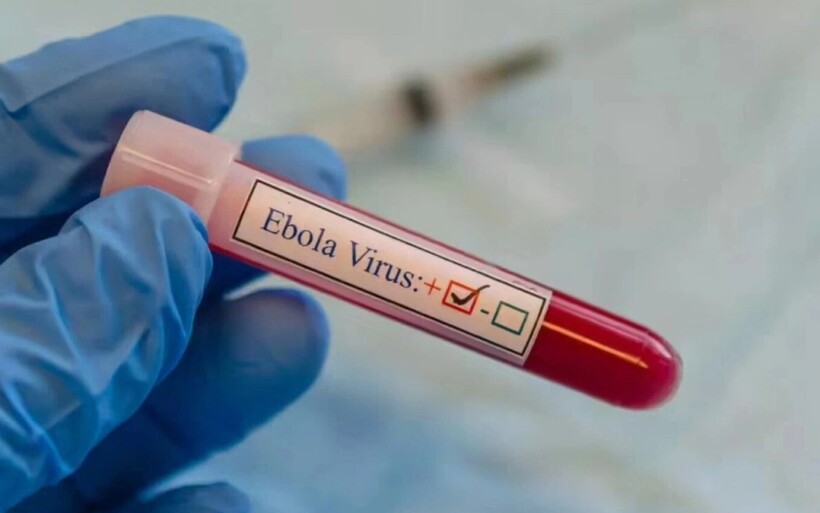 Tăng cường phòng chống Ebola, lưu ý trường hợp nhập cảnh từ nước có dịch trong 21 ngày