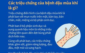 Những thông tin quan trọng về bệnh đậu mùa khỉ