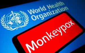 Đã có 78 nước ghi nhận người mắc bệnh đậu mùa khỉ