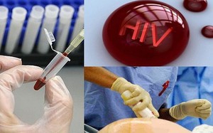 Đề xuất sửa đổi điều kiện xác định người bị phơi nhiễm HIV do tai nạn rủi ro nghề nghiệp