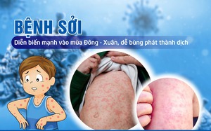 Thủ tướng yêu cầu tăng cường công tác phòng, chống bệnh sởi