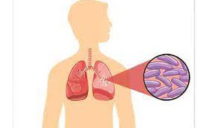 Tăng cường các giải pháp nhằm chấm dứt bệnh Lao vào năm 2030