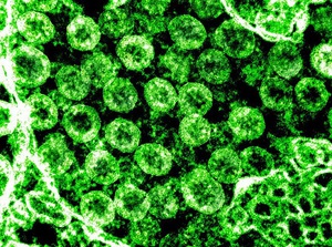 Khí ozone có thể khử khuẩn bề mặt có virus SARS-CoV-2