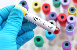 Trình tự thông báo kết quả xét nghiệm HIV dương tính
