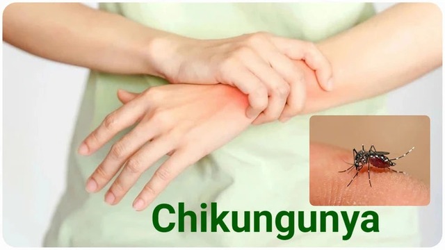 Health ministry: Chikungunya not yet detected in Viet Nam- Ảnh 1.