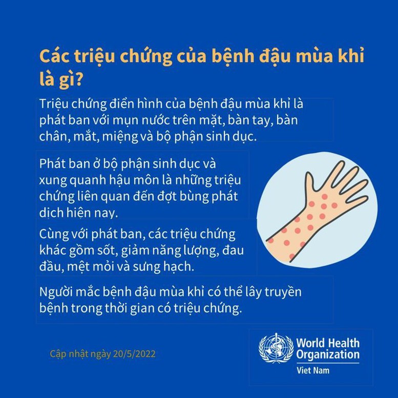 Những thông tin quan trọng về bệnh đậu mùa khỉ - Ảnh 2.