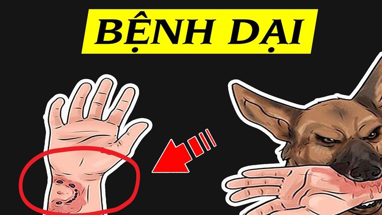 Bộ Y tế cảnh báo nguy cơ bùng phát bệnh dại - Ảnh 1.