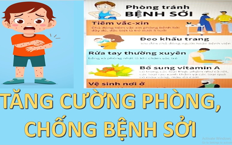 Công điện của Thủ tướng Chính phủ về tăng cường công tác phòng, chống bệnh sởi