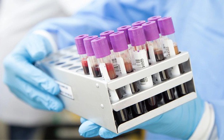 Có phải xét nghiệm máu sẽ phát hiện ung thư?