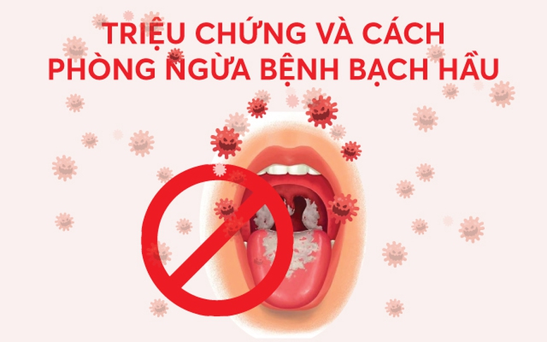 Infographics: Triệu chứng và cách phòng ngừa bệnh bạch hầu