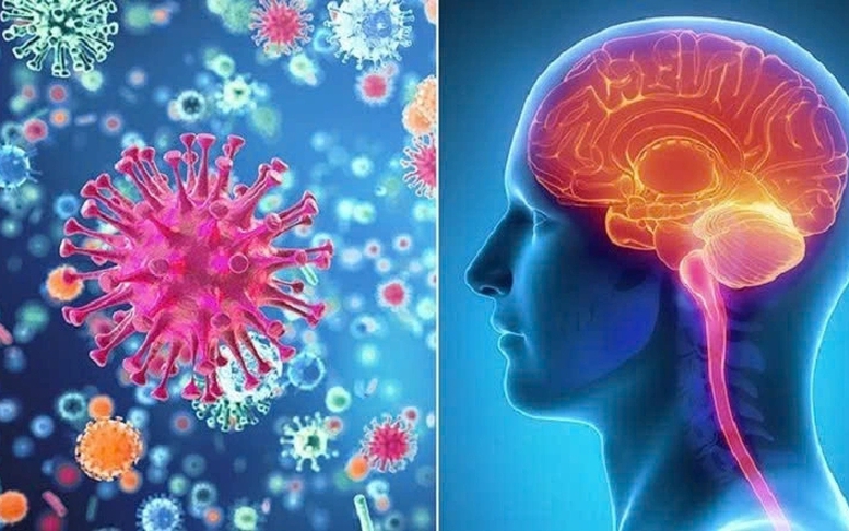 Cảnh báo các ca bệnh não mô cầu xâm lấn: Bệnh không phổ biến nhưng rất nguy hiểm