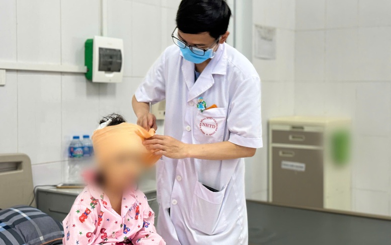 Cảnh báo bệnh dại sắp 'vào mùa'