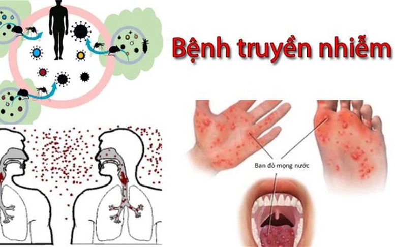 Nhiều bệnh truyền nhiễm đang có xu hướng gia tăng