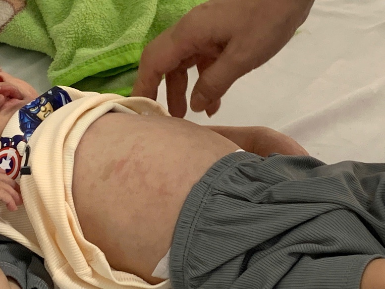 Rà soát đối tượng tiêm vaccine sởi - Ảnh 1.