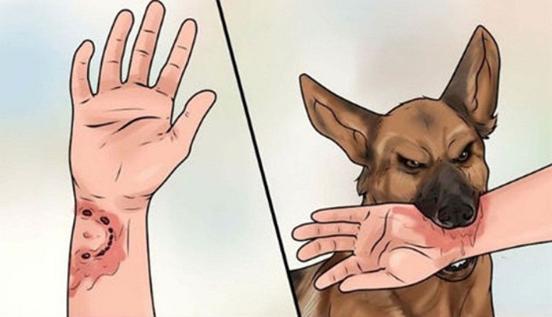 Cách tốt nhất phòng tránh bệnh dại- Ảnh 1.
