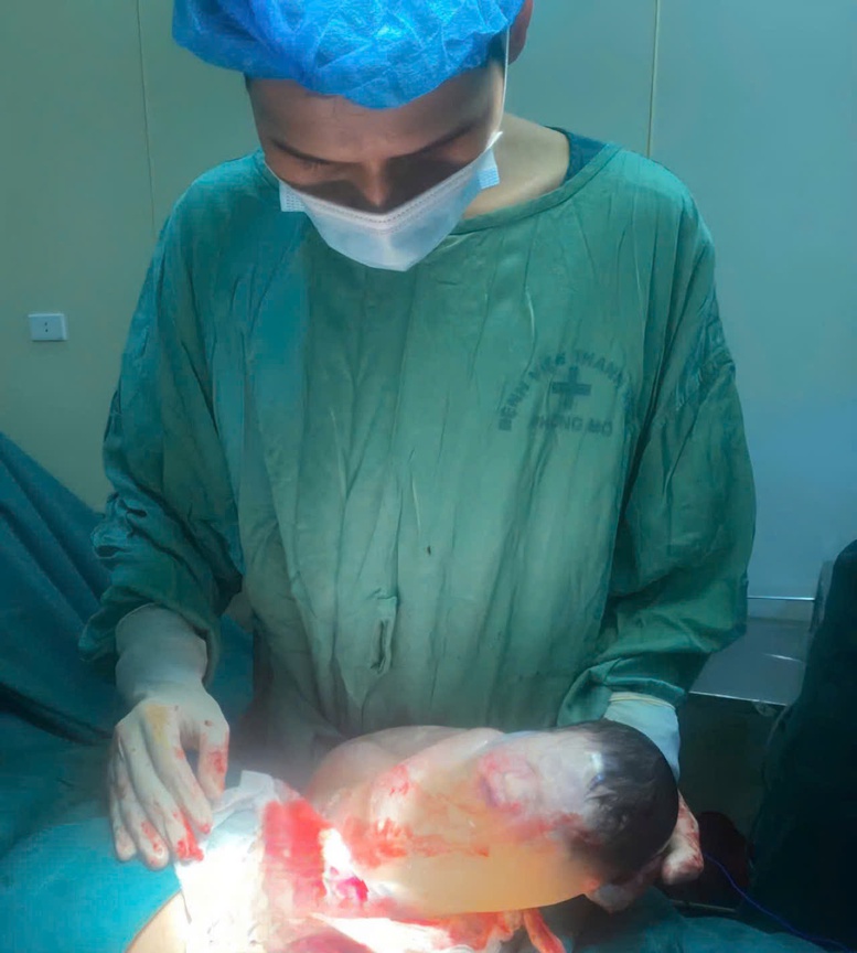 Khoảnh khắc hiếm gặp: Trẻ sơ sinh chào đời còn nguyên trong bọc ối- Ảnh 1.