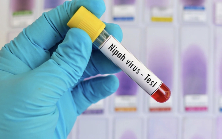 Không chủ quan với dịch bệnh do virus Nipah