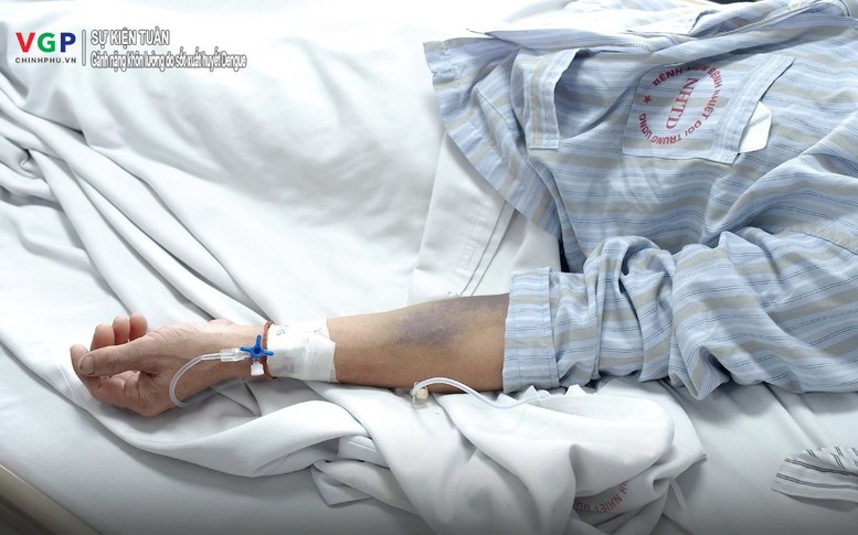 Chữa trị sốt xuất huyết Dengue: Khi gánh nặng vượt qua những con số