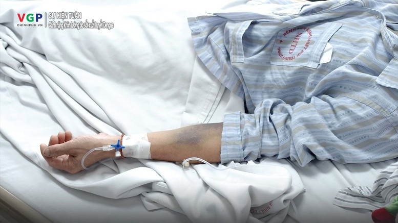 Chữa trị sốt xuất huyết Dengue: Khi gánh nặng vượt qua những con số- Ảnh 1.