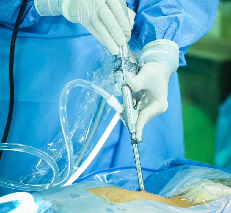 Bệnh lý cột sống: Bước tiến khoa học từ các kỹ thuật ít xâm lấn thế hệ mới - Ảnh 1.