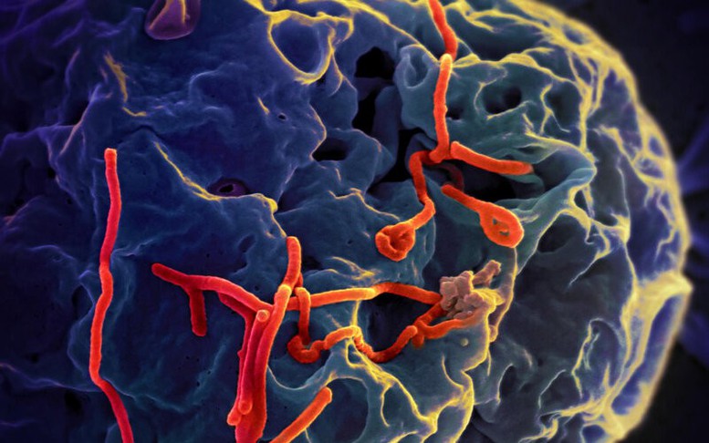 Bộ Y tế thông tin diễn biến phức tạp của dịch bệnh do virus Ebola