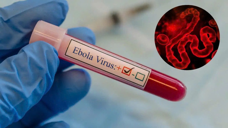 Virus Ebola có xu hướng lan rộng và biện pháp phòng ngừa của các nước- Ảnh 1.