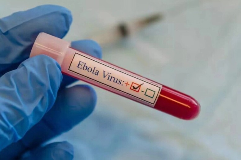 Tăng cường phòng chống Ebola, lưu ý trường hợp nhập cảnh từ nước có dịch trong 21 ngày- Ảnh 1.