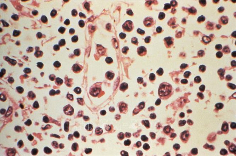 Virus Hanta: Xác nhận 6 ca nhiễm, nguy cơ lây lan toàn cầu ở mức thấp- Ảnh 1.