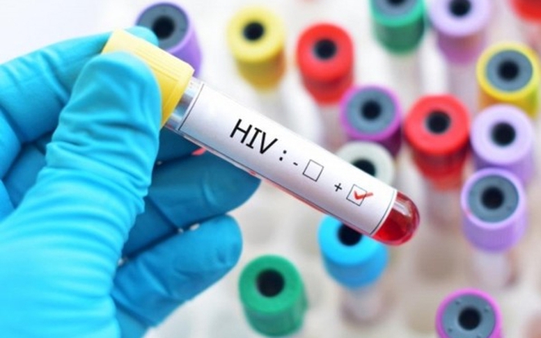 Quy định mới về cấp giấy chứng nhận bị phơi nhiễm HIV do tai nạn rủi ro nghề nghiệp- Ảnh 1.