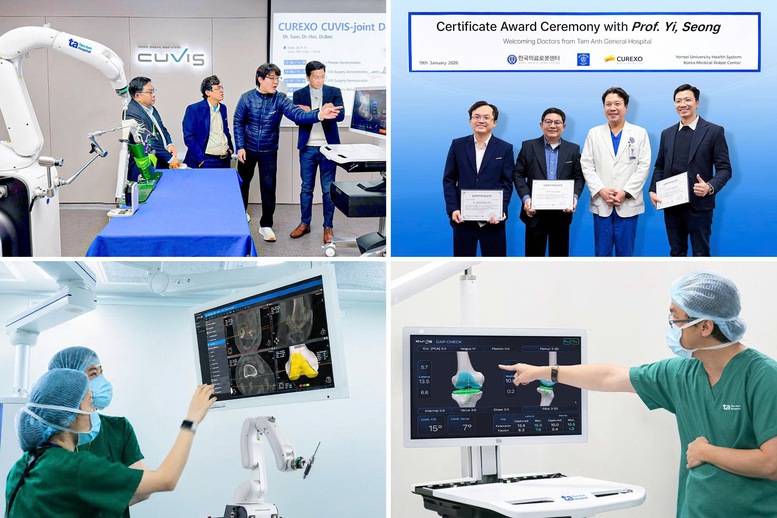 Top đầu thế giới, Bệnh viện Tâm Anh vượt mốc 100 ca thay khớp khó nhờ "siêu robot" AI- Ảnh 2.