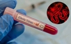 Siết chặt kiểm soát dịch Ebola tại các cơ sở y tế