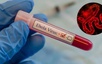 Health ministry urges localities to strengthen Ebola surveillance and preparedness