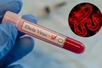 Siết chặt kiểm soát dịch Ebola tại các cơ sở y tế
