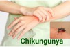 Health ministry: Chikungunya not yet detected in Viet Nam