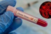 Health ministry urges localities to strengthen Ebola surveillance and preparedness