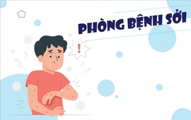 Infographics: Bệnh sởi và các biện pháp phòng bệnh