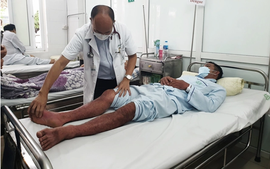 Sốt xuất huyết Dengue: Đừng để nguy kịch vì chủ quan