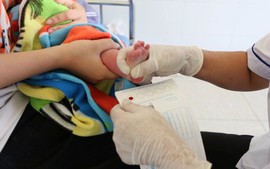 6 triệu người Việt Nam chịu ảnh hưởng bệnh hiếm: Cần giải pháp quản lý toàn diện